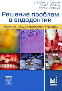 Решение проблем в эндодонтии. Профилактика, диагностика и лечение #1