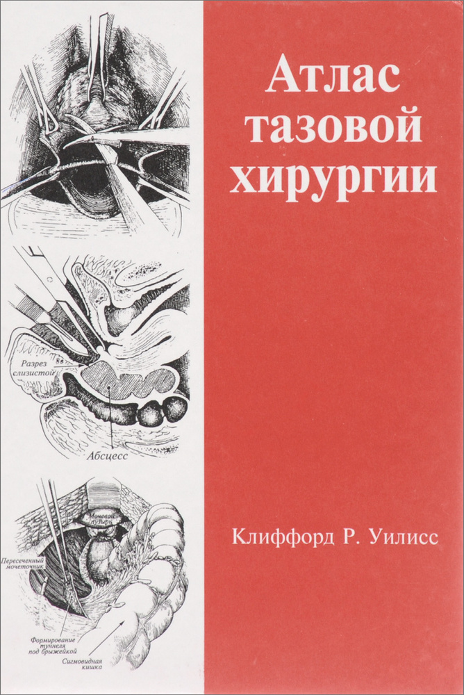Атлас тазовой хирургии - купить с доставкой по выгодным ценам в ...