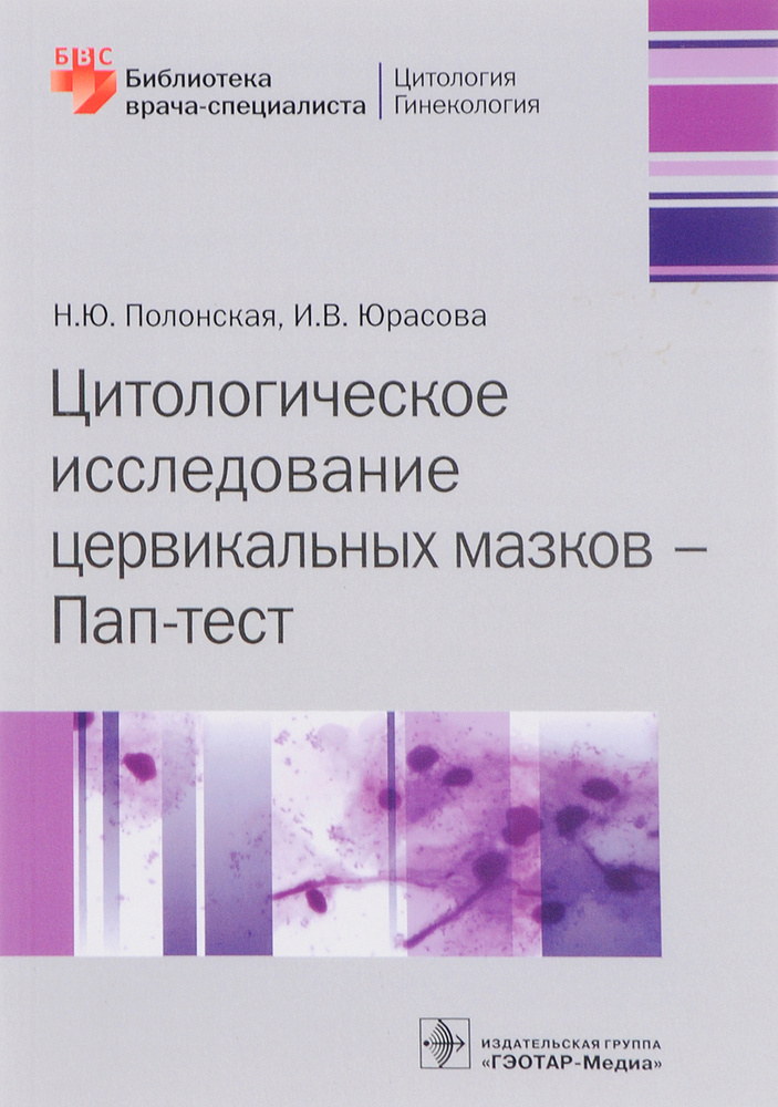 Цитологическое исследование цервикальных мазков. Пап-тест | Юрасова Ирина Владимировна, Полонская Наталия #1