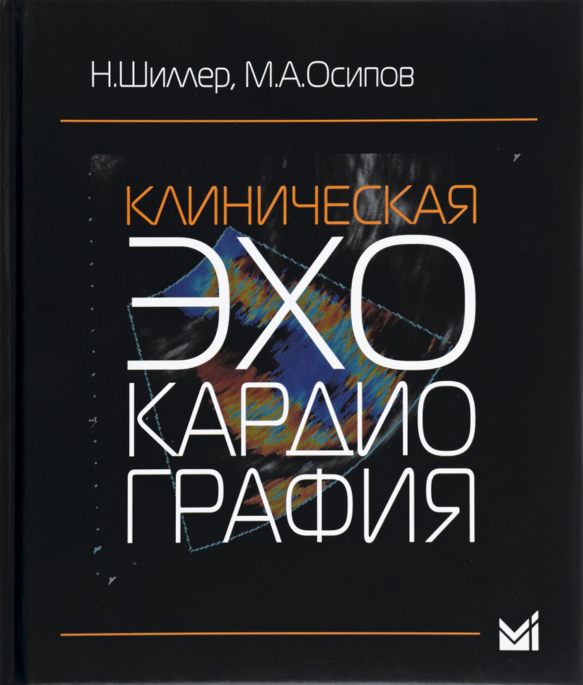 Клиническая эхокардиография. 3-е издание | Шиллер Нельсон Б. - купить с  доставкой по выгодным ценам в интернет-магазине OZON (321858415)