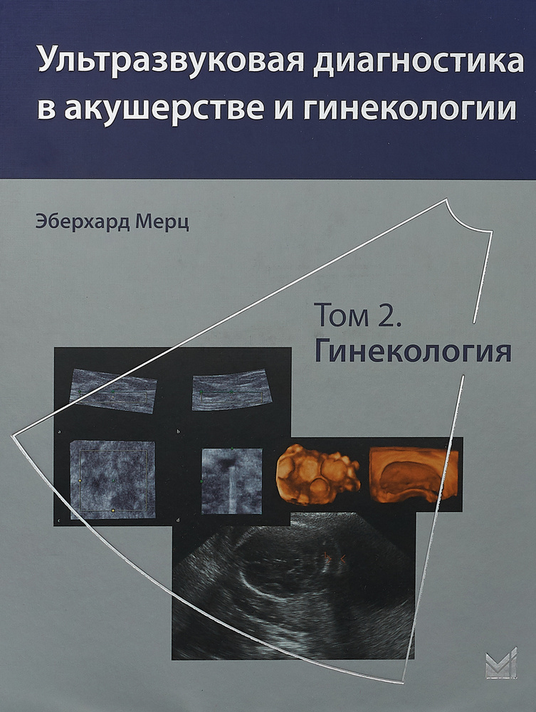 Ультразвуковая диагностика в акушерстве и гинекологии. Том 2. Гинекология | Мерц Эберхард #1