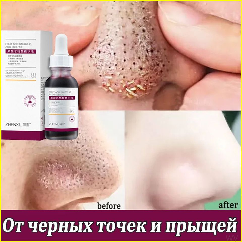 LYDIMOON Сыворотка для ухода за кожей, 30 мл #1
