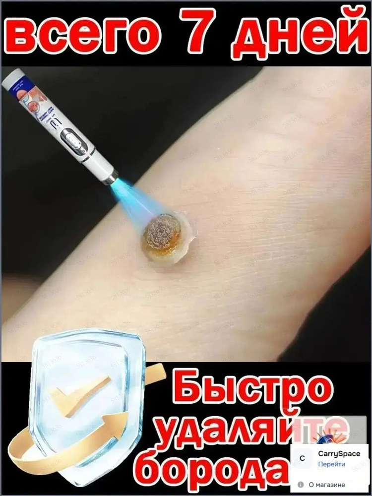 Пилинг #1