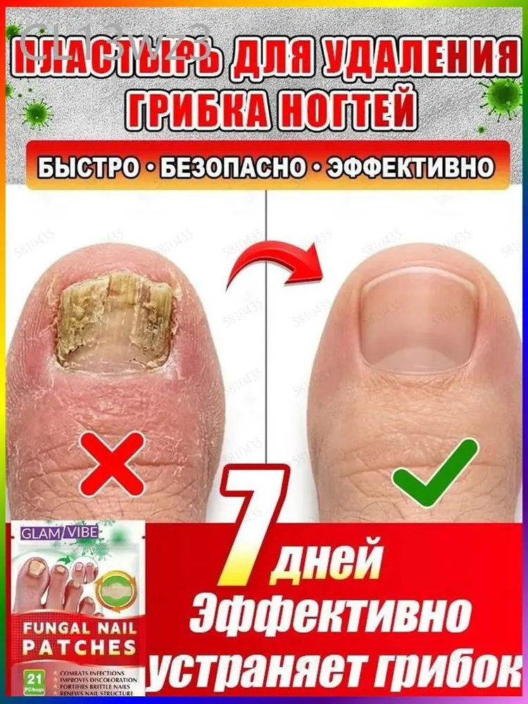 Патчи #1