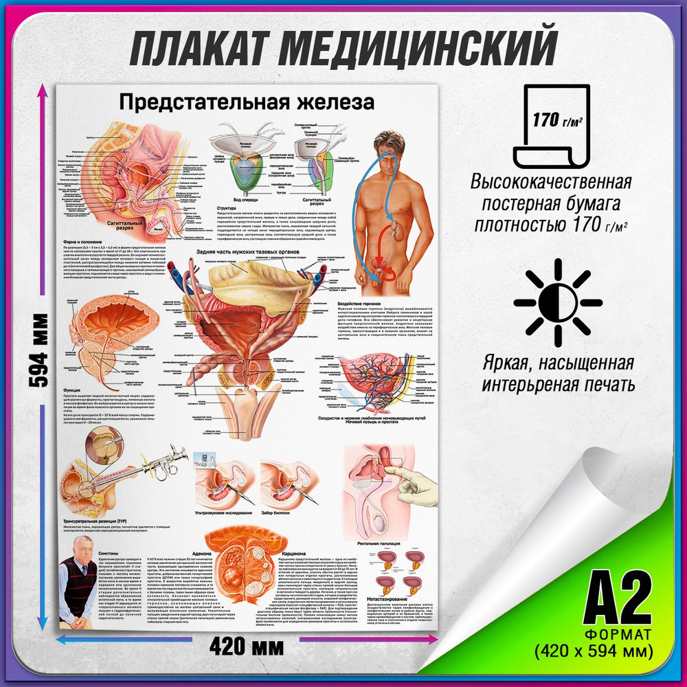 Информационный медицинский плакат "Предстательная железа" / А-2 (42x60 см.)  #1