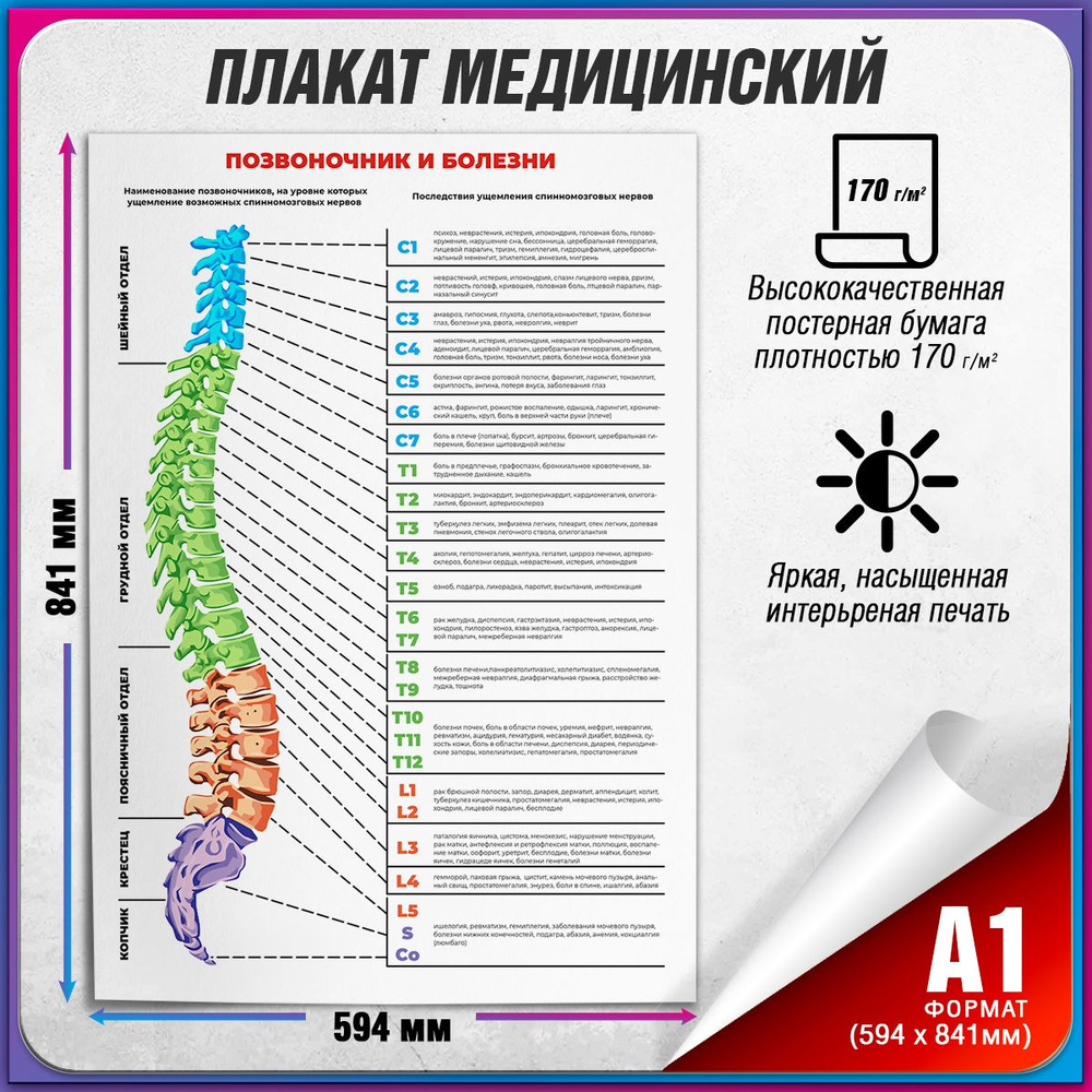 Информационный медицинский плакат "Позвоночник и болезни" / А-1 (60x84 см.)  #1