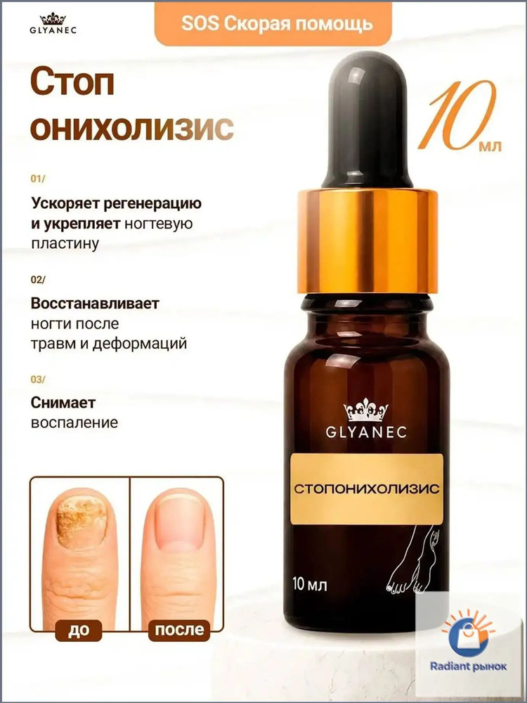 Стоп онихолизис #1