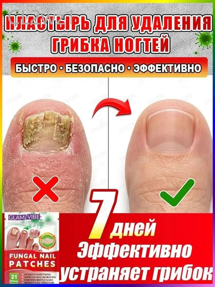 Патчи #1