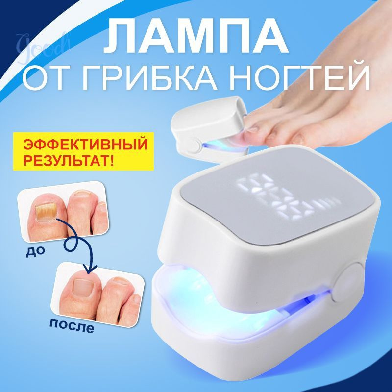 Фототерапия #1