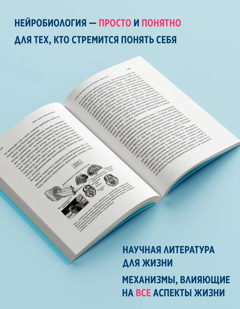 Мозг: ваша личная история, вариант, фото 3