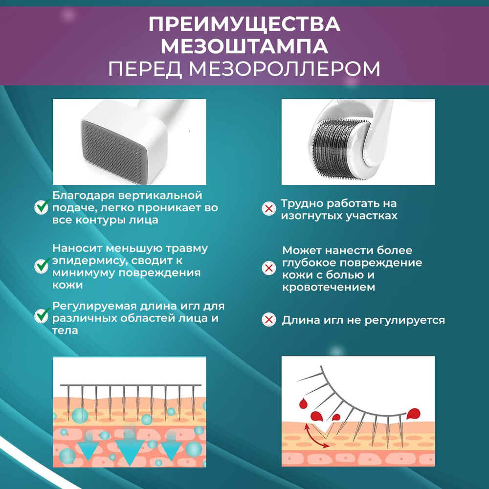 Мезороллер #1