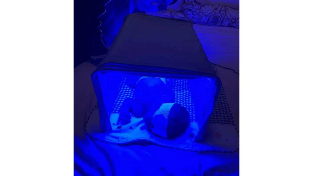 фотолампа для новорожденных от желтушки/ кувез фотолампа от желтушки  #1
