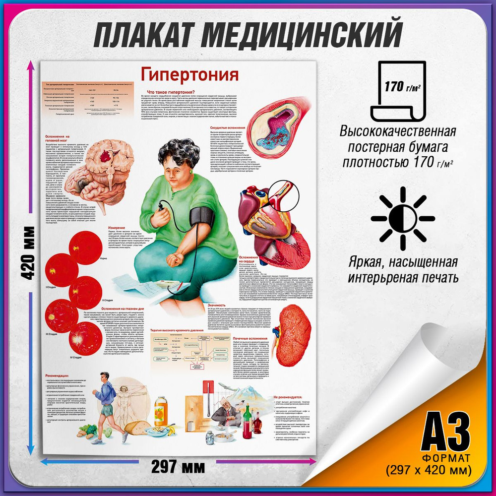 Информационный медицинский плакат "Гипертония" / А-3 (30x42 см.)  #1