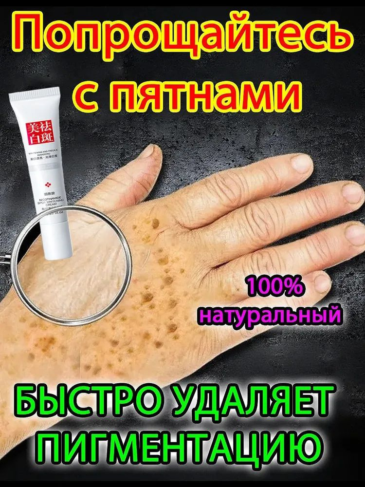 Отбеливающий крем от веснушек и солнечных пятен, подходит для удаления и исчезновения желтых пятен и #1