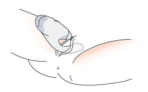 клитор @vidoza