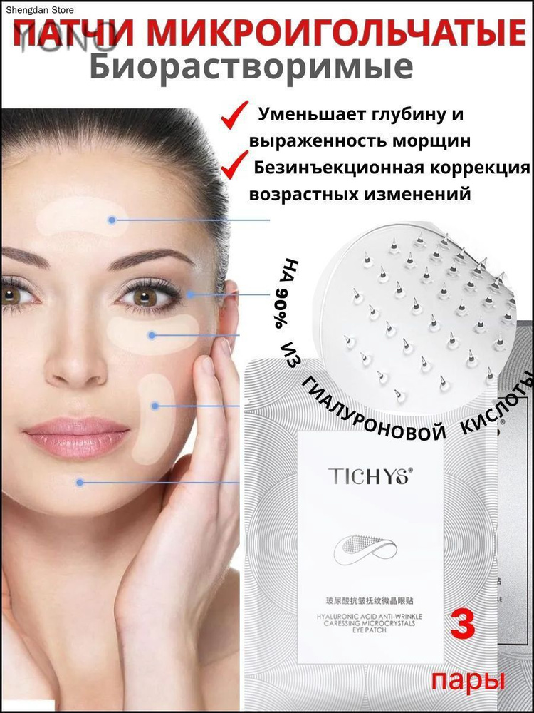 Патчи #1
