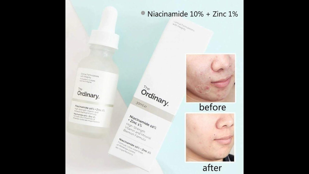 The Ordinary Эмульсия для ухода за кожей Очищение, 32 мл #1