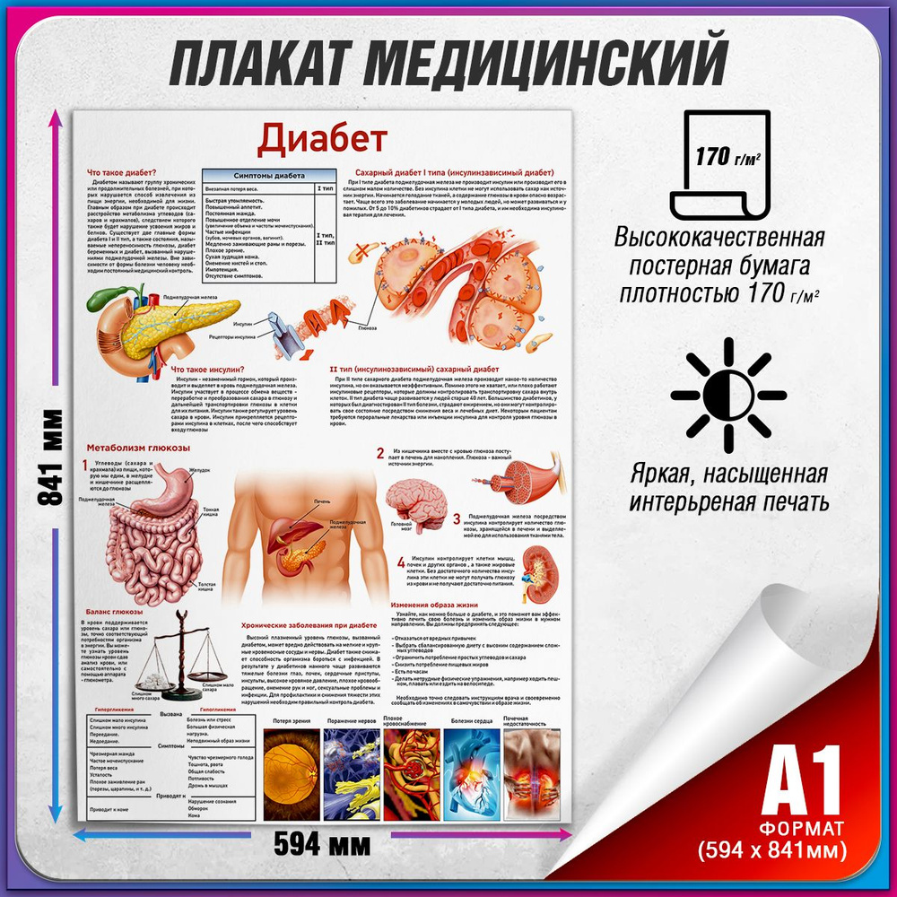 Информационный медицинский плакат "Диабет" / А-1 (84x60 см.) #1