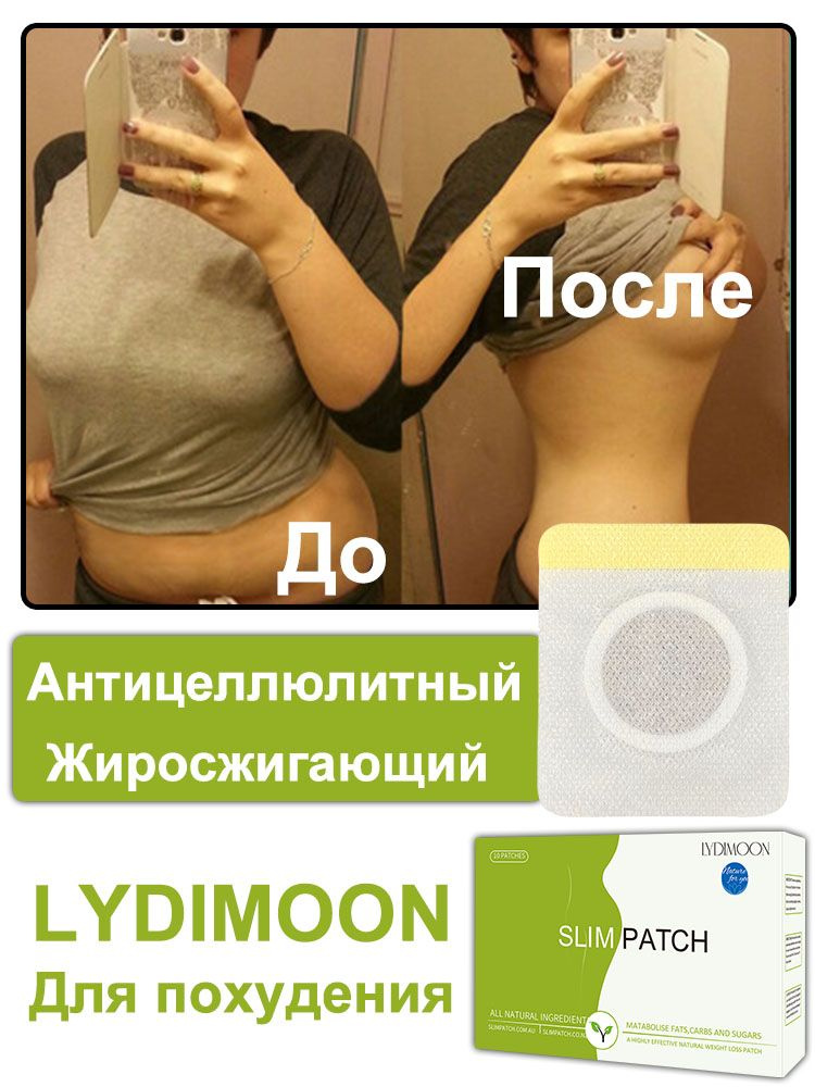 Патчи #1