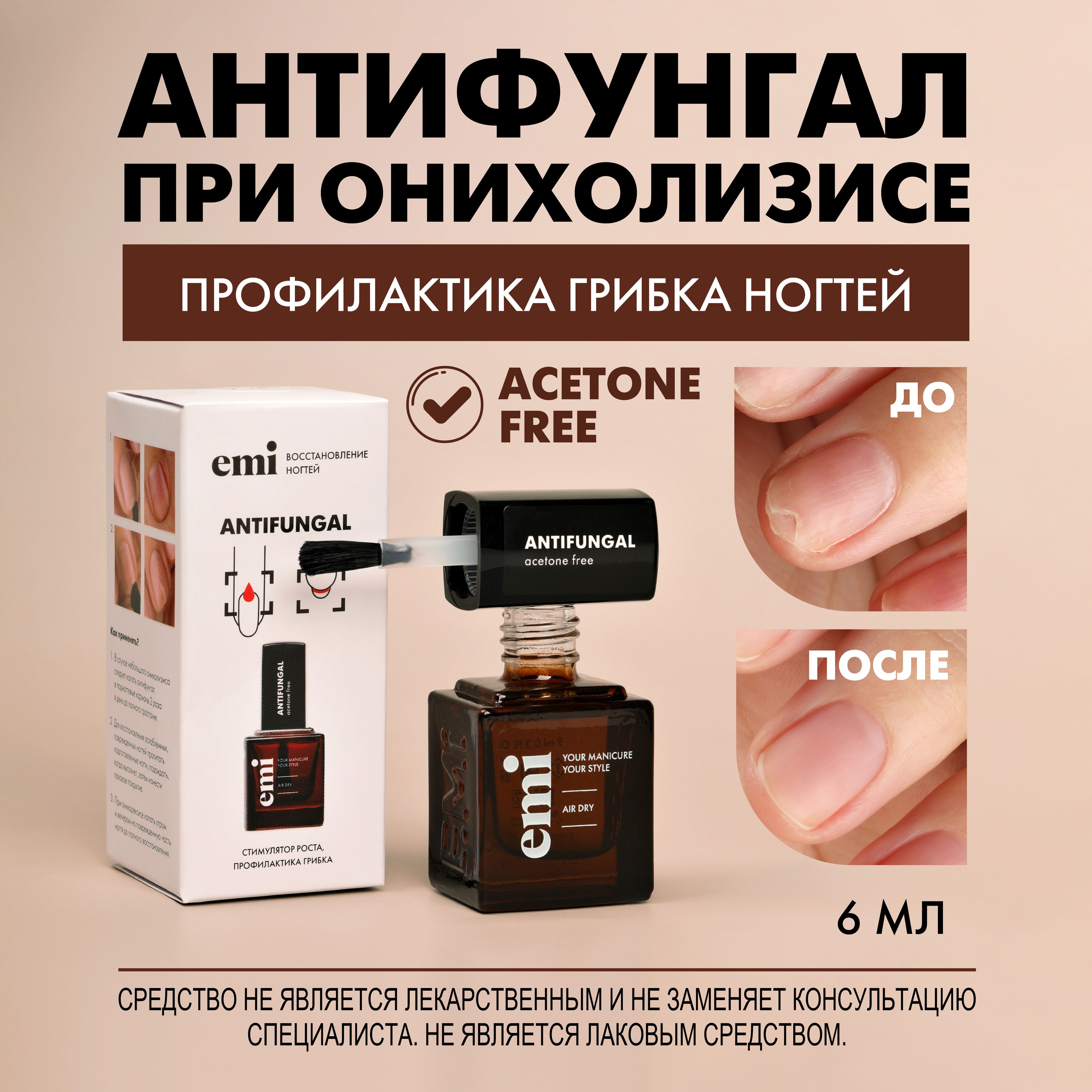 EMIСредствоотгрибканогтейнаногахирукахАнтифунгал,6мл