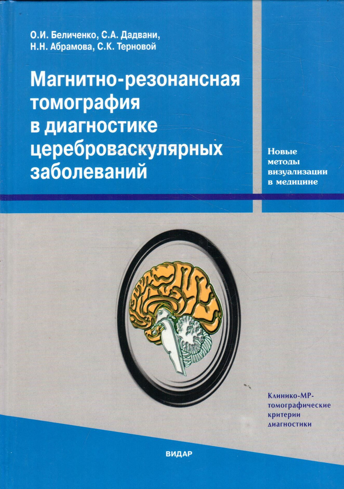 Магнитно-резонансная томография в диагностике цереброваскулярных заболеваний | Беличенко Олег Игоревич, #1