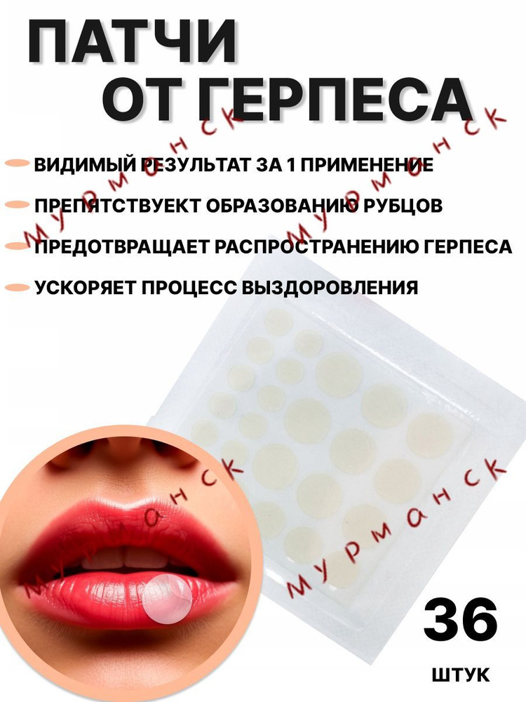 Патчи #1