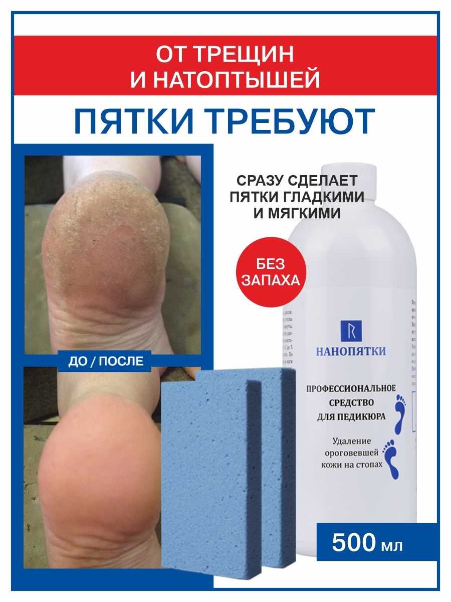 НАНОПЯТКИПрофессиональноесредстводляпедикюра,500мл+Пемзакосметическая,2шт.