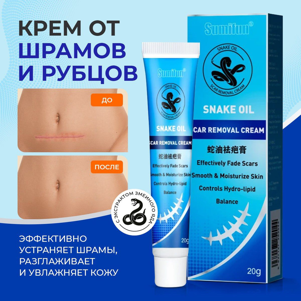 Лечение дерматита в Москве - получите консультацию косметолога в Face Clinic