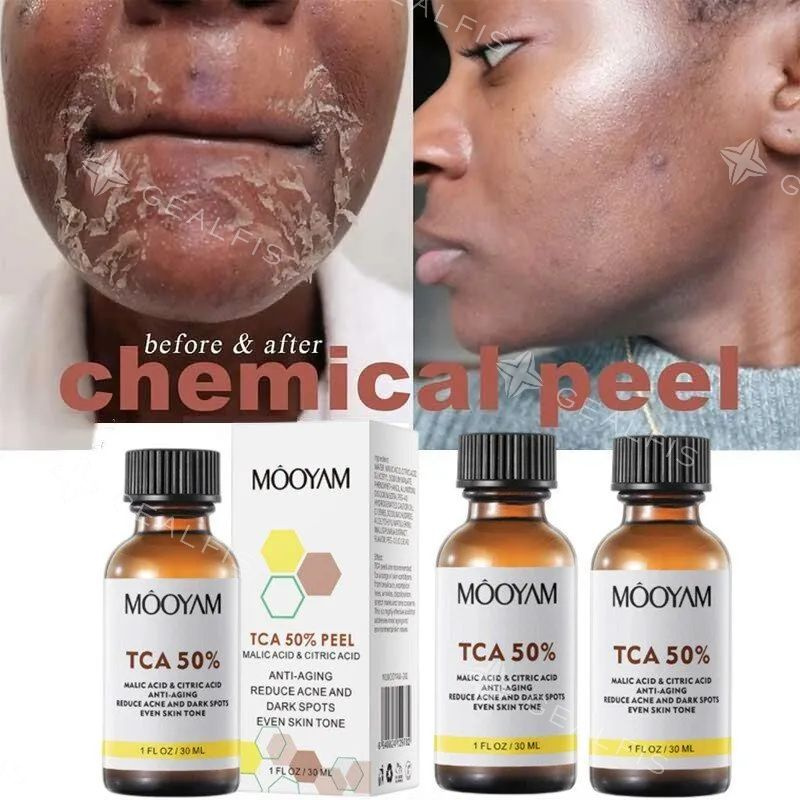 Сотталушы сотталғанды ұрады