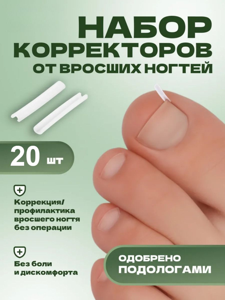 Корректор От Вросших Ногтей На Ногах #1