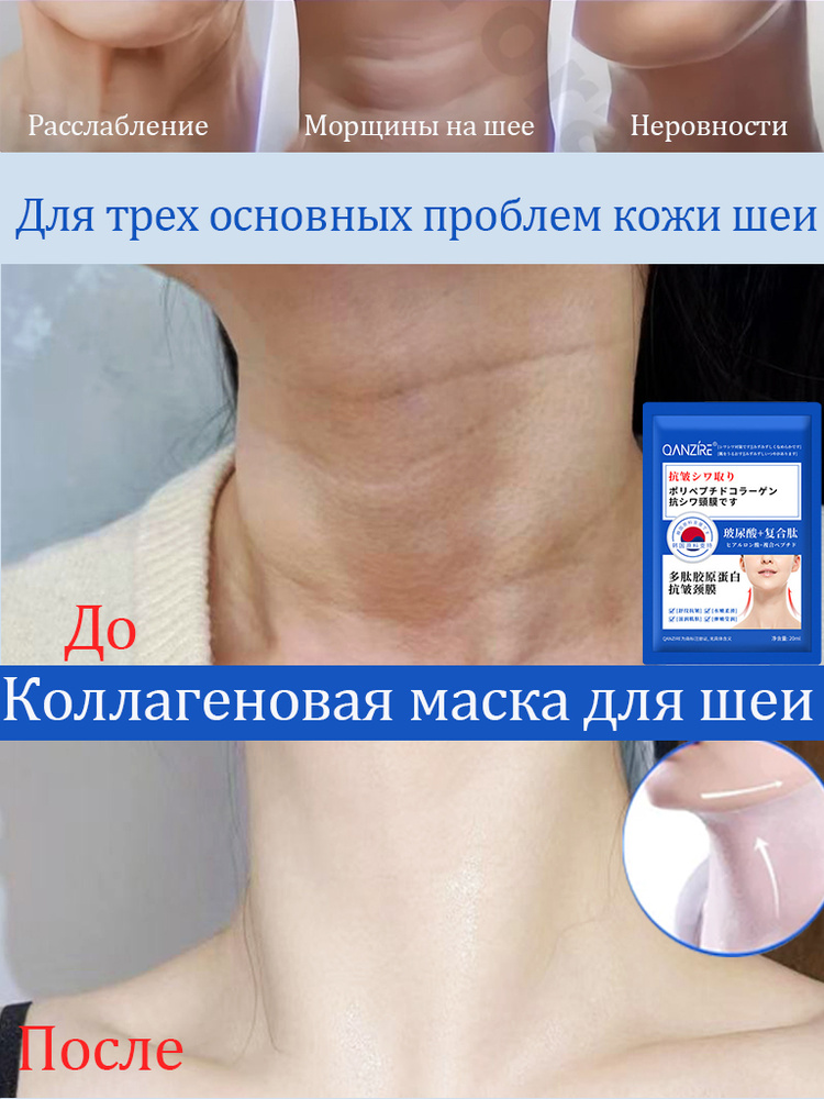 Патчи #1