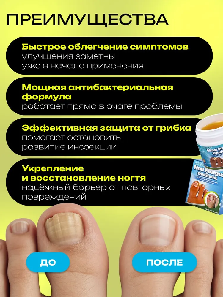 Мазь от грибка ногтей на ногах / Противогрибковое эффективное средство / Крем от грибка стоп и ногтей, вариант, фото 4