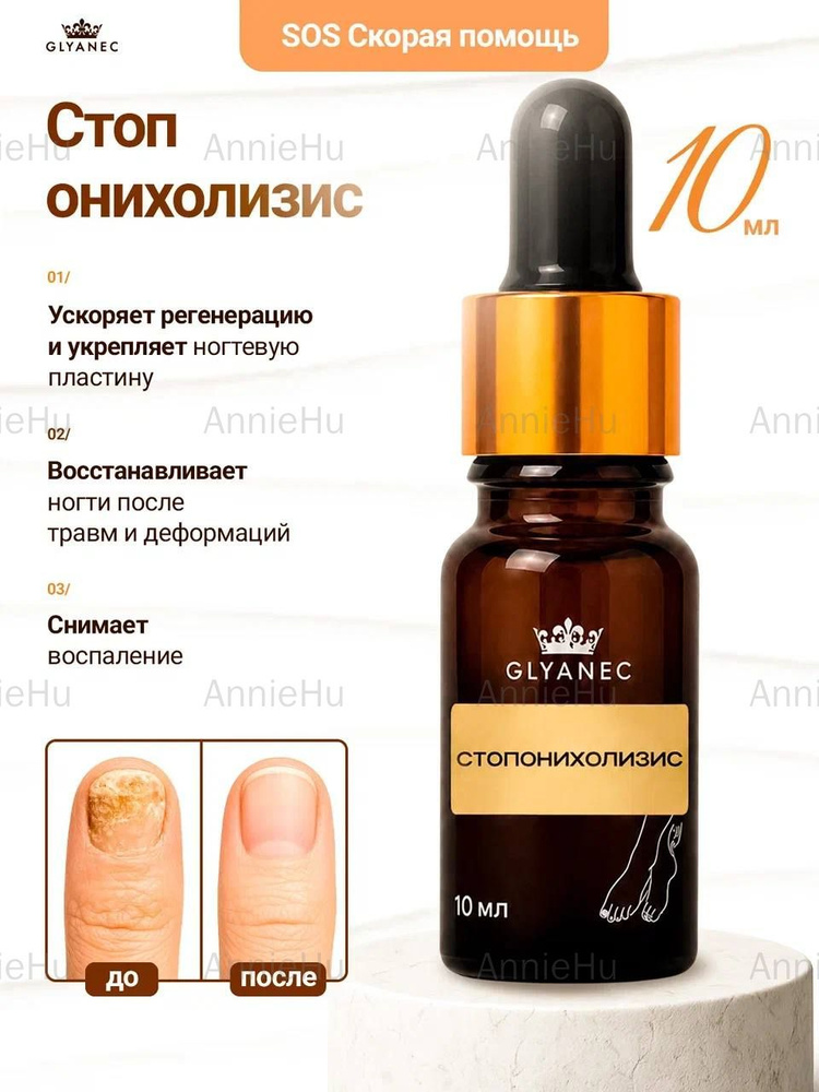 Стоп онихолизис #1