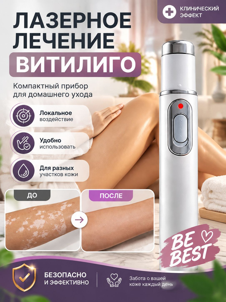 Фототерапия #1