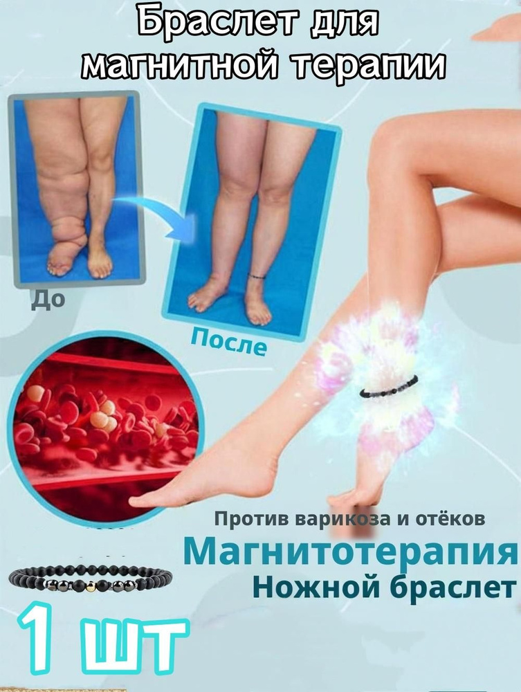 Браслет #1