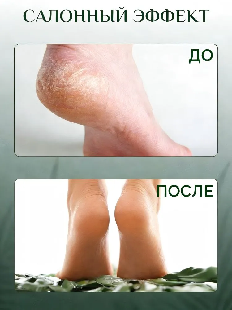 Педикюрный нож-скребок для стоп с двусторонним лезвием безопасное удаление огрубевшей кожи и мозолей, инструмент для домашнего ухода за пятками, вариант, фото 2