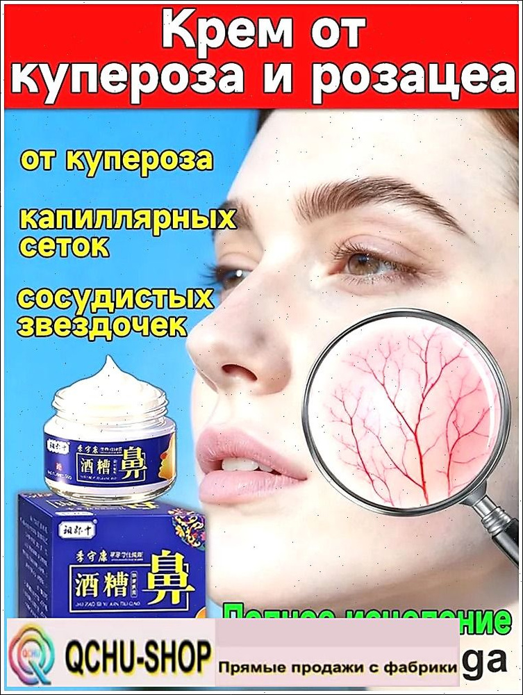 Мазь от Китайский розацеа на лице купероза и покраснений #1