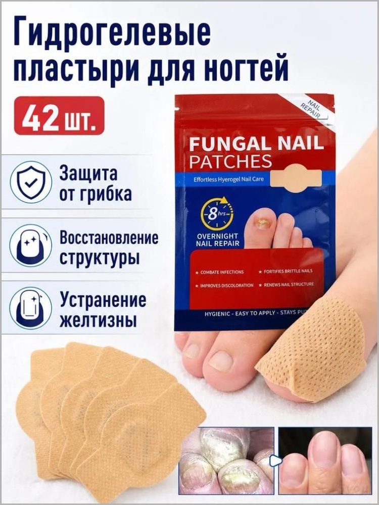 Пилинг #1