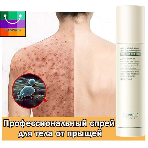 Сыворотка-спрей для тела AcneFree ,от прыщей акне и воспалений,150мл  #1