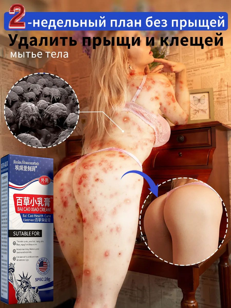 Заживляющая китайская чудо мазь для тела, лица, рук, ног и пяток. Негормональное средство от прыщей, #1
