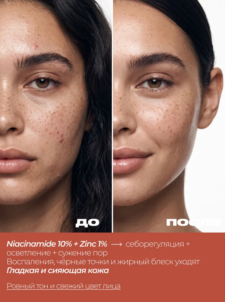 The Ordinary Сыворотка для лица с ниацинамидом 10% и цинком 1% / Niacinamide 10% + Zinc 1%, 30 мл, 30 мл, фото 3