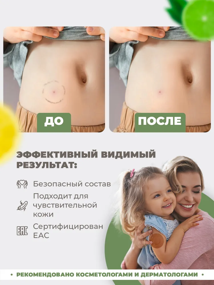Очиститель для кожи вокруг стомы 4SKINcare Super REMOVER Цитрусовый микс, ремувер для снятия тейпов и пластырей, антиклей медицинский, спрей, 115 мл, 115 мл, фото 3