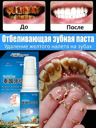 Спрей от зубного камня, легко убирает налет на зубах