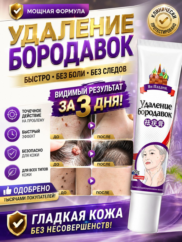 Крем для лечения папиллом и бородавок, эффективно лечит родинки, папилломы и разные виды бородавок. Безболезненно, #1