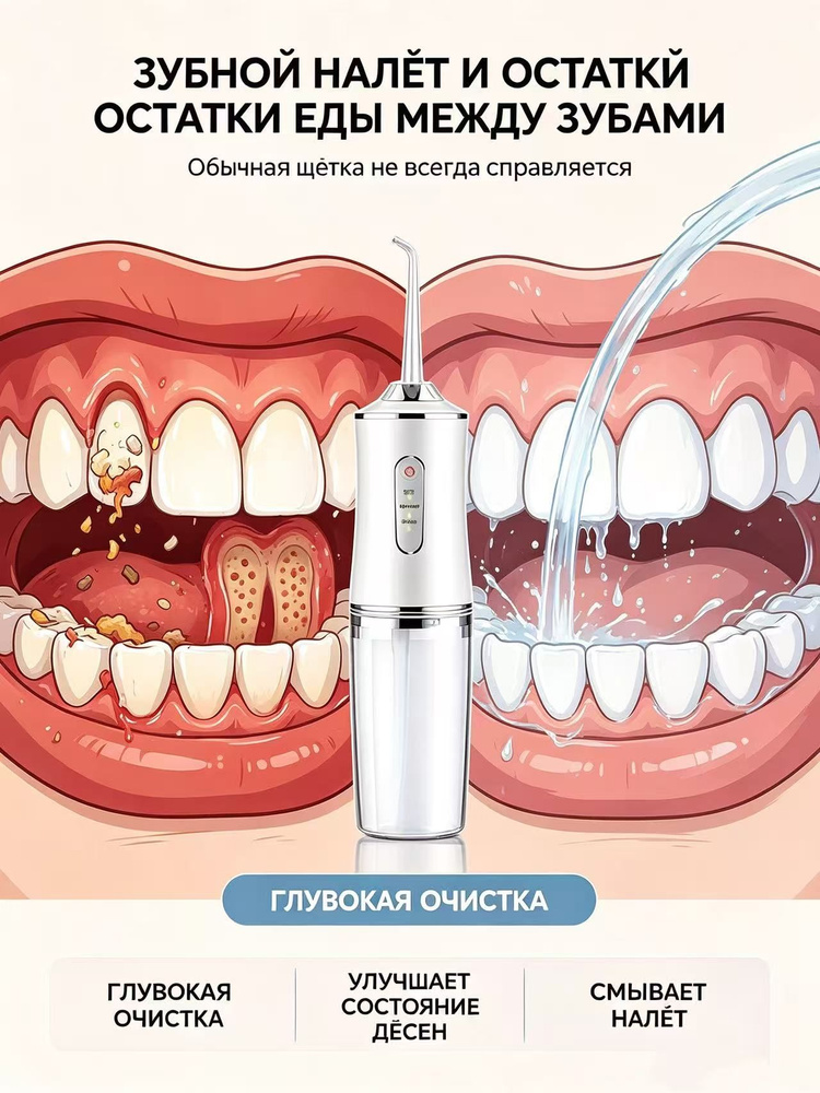 ирригатор для полости рта #1