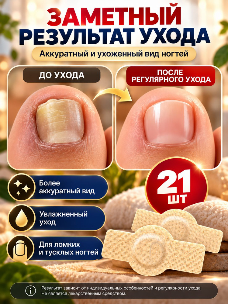 Патчи #1