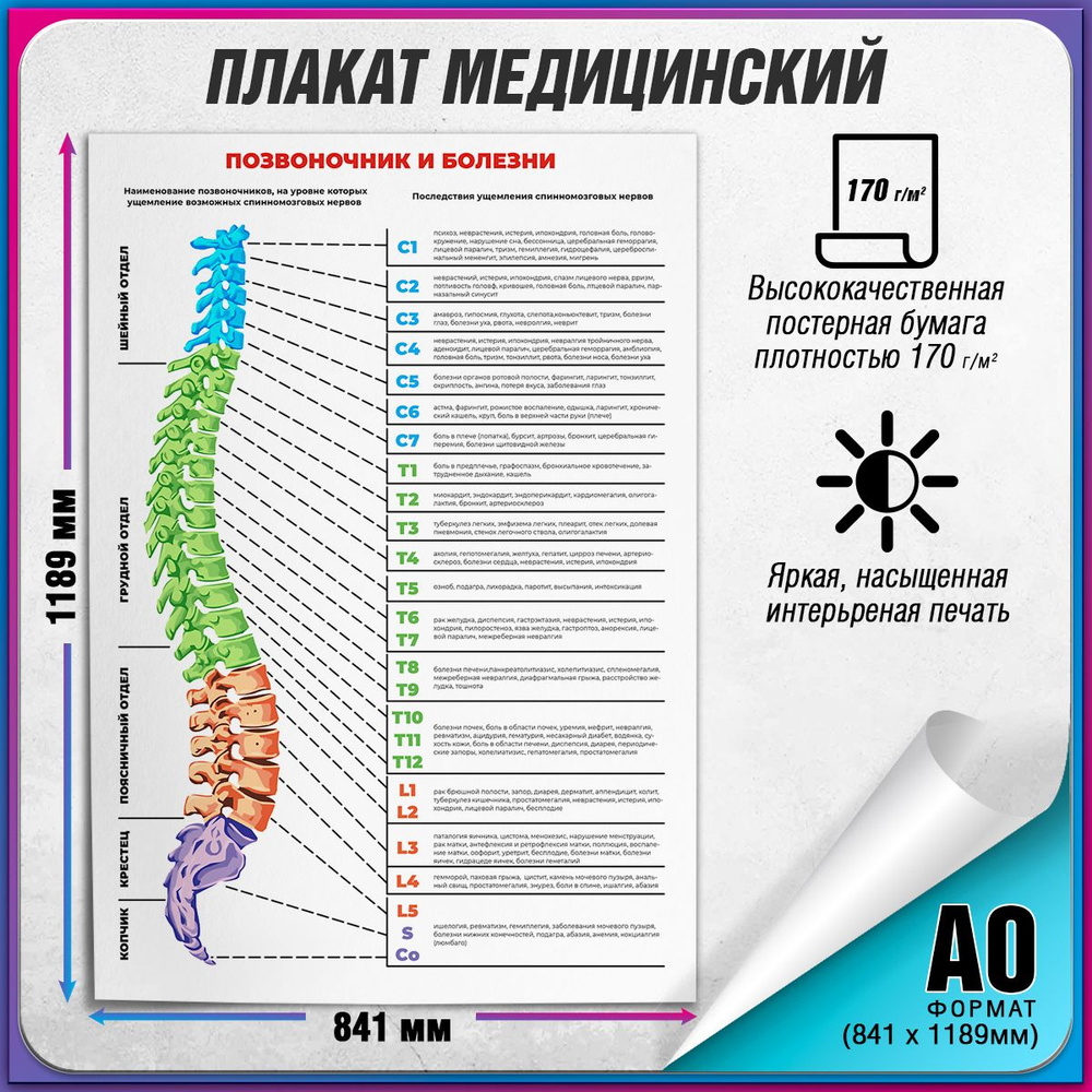 Информационный медицинский плакат "Позвоночник и болезни" / А-0 (84x119 см.)  #1