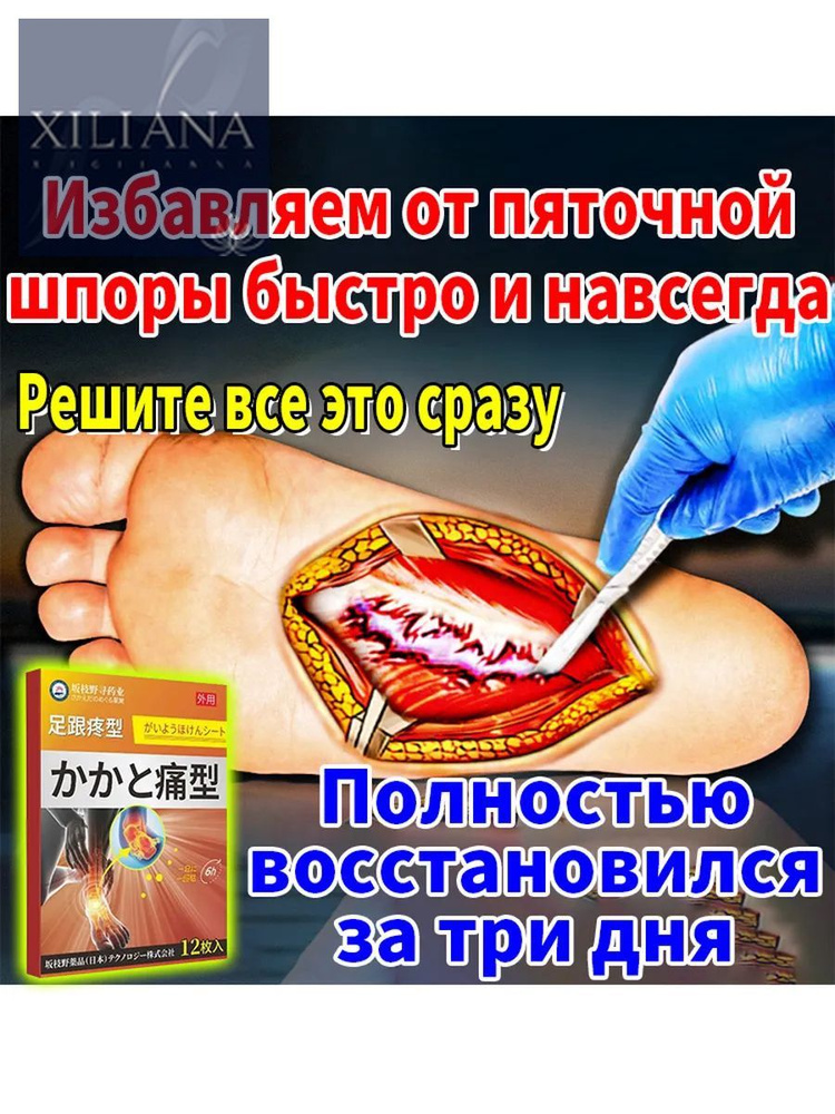 Патчи #1