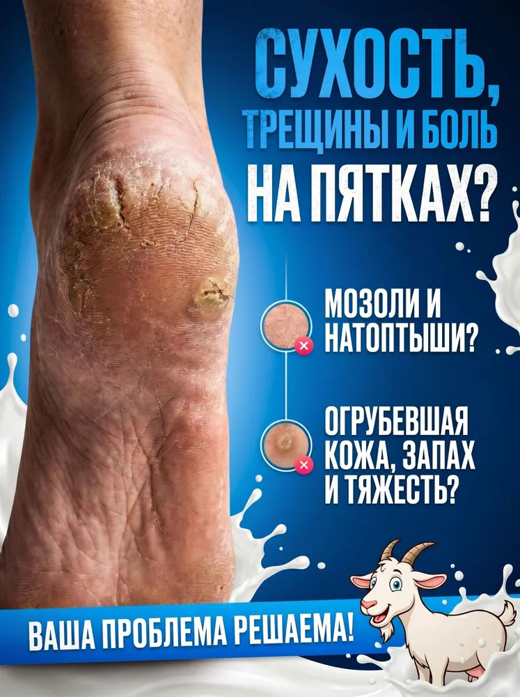 Маска-носочки для ног с козьим молоком, 3 пары, отшелущивающее увлажняющиее педикюрное спа средство для ухода за кожей ног / Альтернатива ванночкам для ног, пемзе и пилингу, устранение трещин, вариант, фото 2