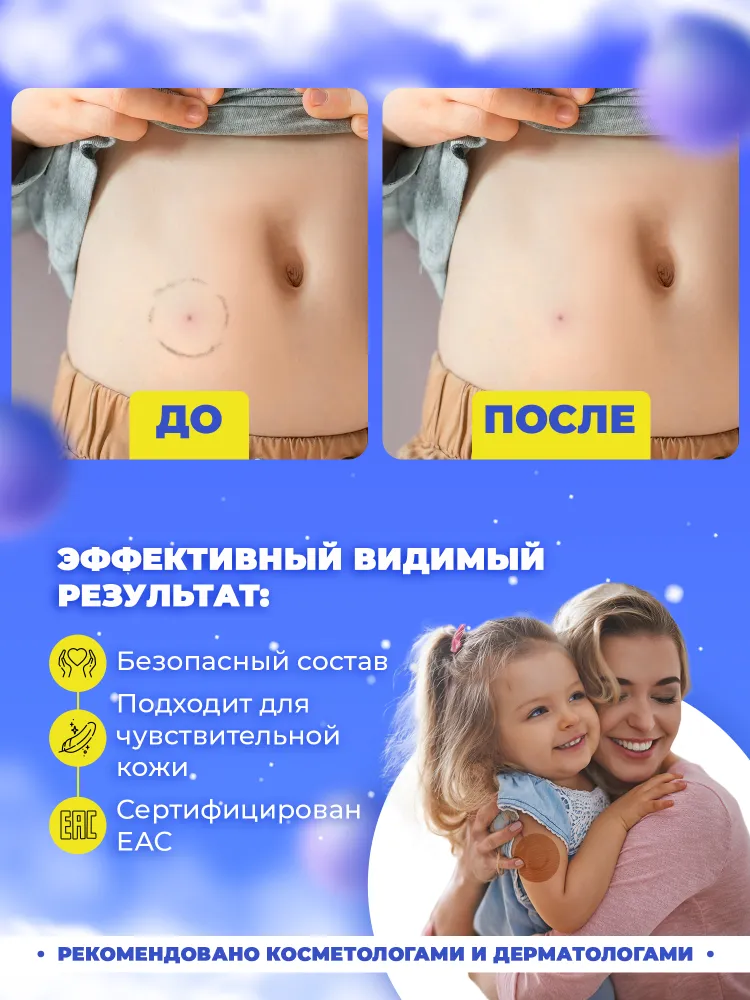 Очиститель для кожи вокруг стомы 4SKINcare Super REMOVER Лимонная карамель, ремувер для снятия тейпов и пластырей, антиклей медицинский, спрей, 115 мл, 115 мл, фото 3